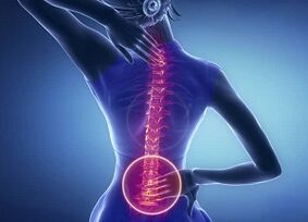 jostas osteohondrozes izpausmes